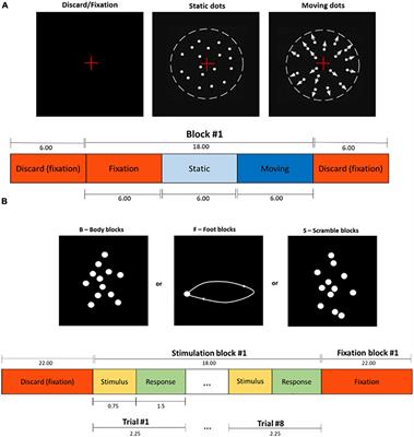 Task-based functional MRI challenges in clinical neuroscience: Choice of the best head motion correction approach in multiple sclerosis